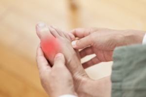 Symptoms and Stages of Gout