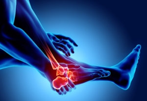 How Climate and Humidity Can Influence Lower Limb Arthritis