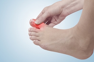 Managing Gout Flares and Protecting Your Foot Health