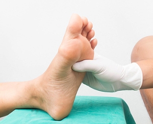 How Peripheral Neuropathy Affects the Feet